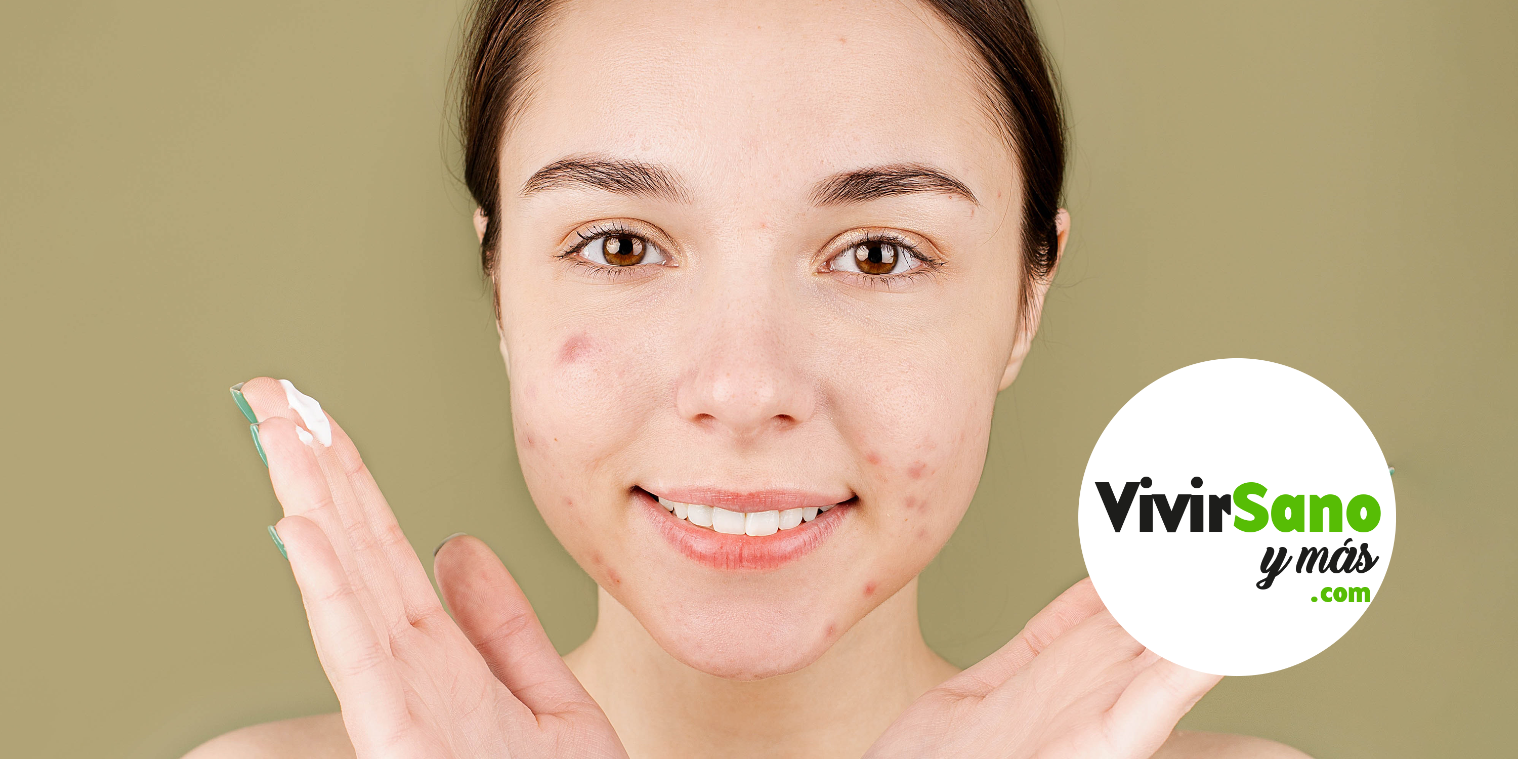 8 tips para alejar el acné.png